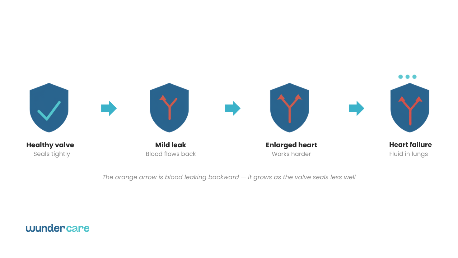 Educational infographic explaining the stages of mitral valve disease in dogs, from a healthy heart to congestive heart failure with early detection guidance.
